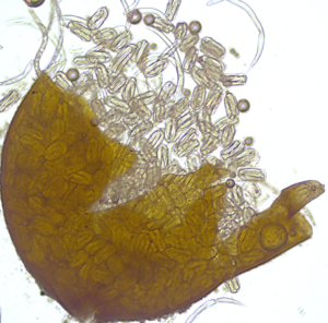 A broken-open cyst of a potato cyst nematode, showing the hundreds of nematode eggs in just one cyst. A cyst can survive for 20+ years in the soil in the absence of a host crop. Photo: Dandurand program at University of Idaho.