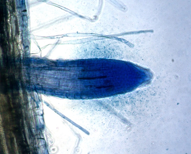 Study: How plants harness microbes to get nutrients